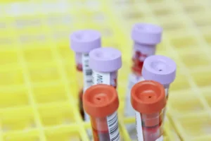 Ce analize de sânge se fac pentru infecții